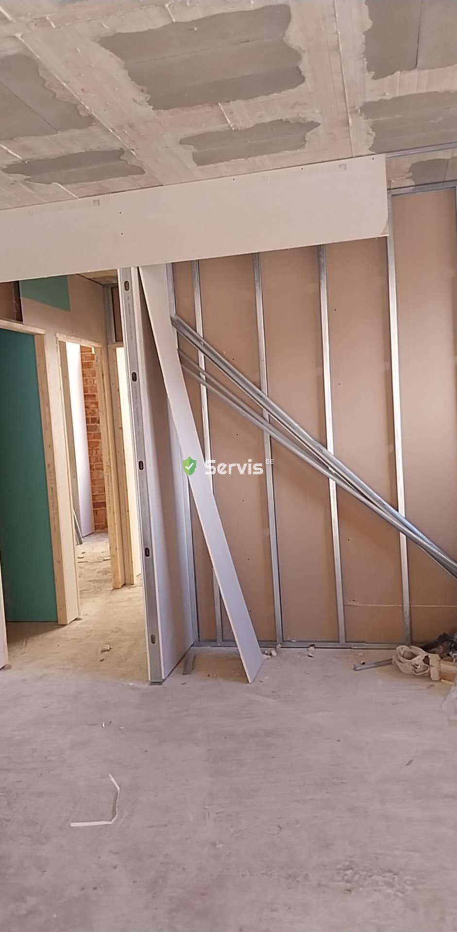 გიფსო კარდონის სპეციალისტი მრავალწლიანი გამოცდილებით