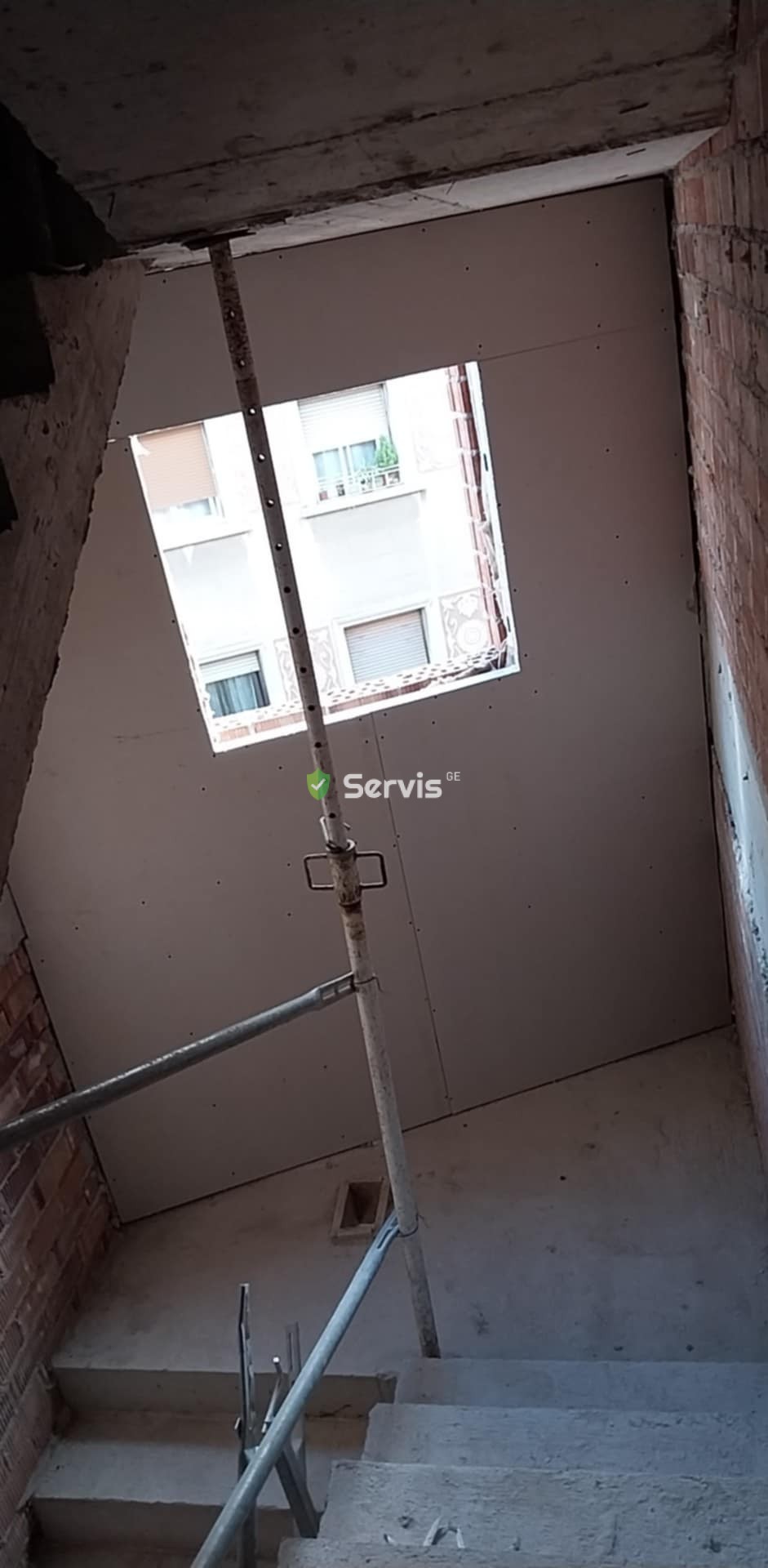 გიფსო კარდონის სპეციალისტი მრავალწლიანი გამოცდილებით